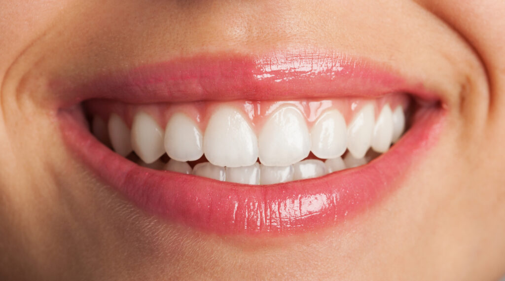 teeth whitening in santa monica