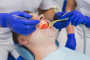 Santa Monica tooth extraction
