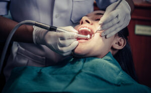 tooth extraction