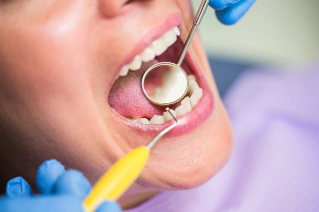 gum treatment