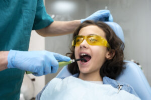 Fluoride Treatment