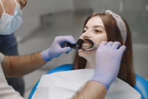 traditional metal braces