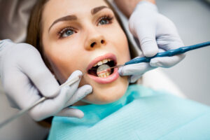 dental fillings