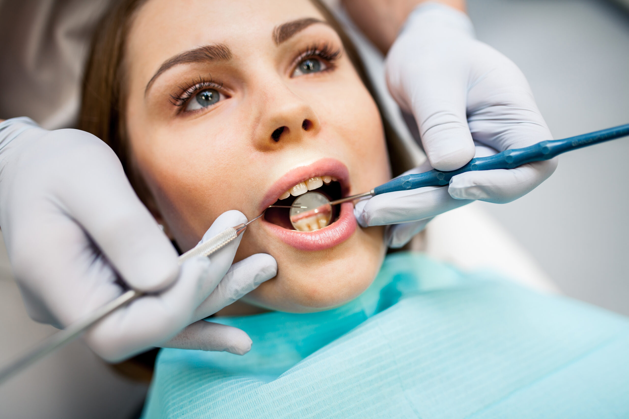 dental fillings