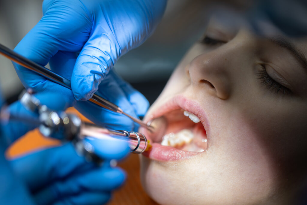 Dental Onlay