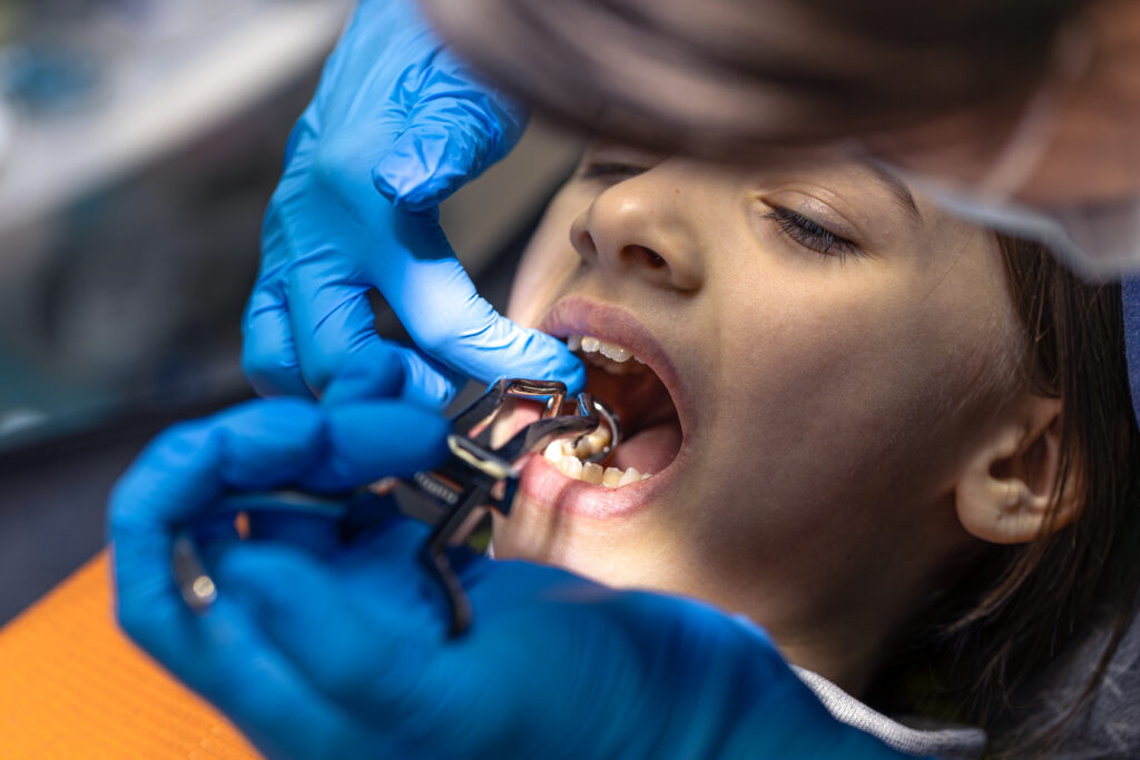 tooth extraction