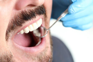 Dental Crowns dentist