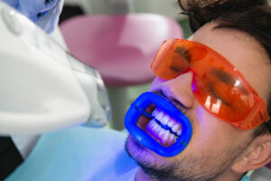 Teeth Whitening in santa monica